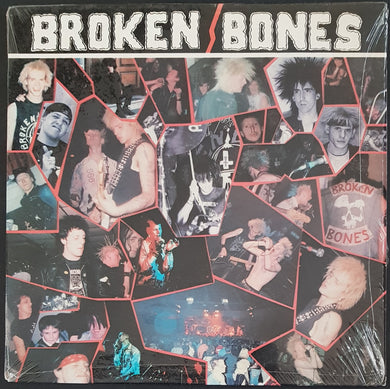 Broken Bones - Never Say Die